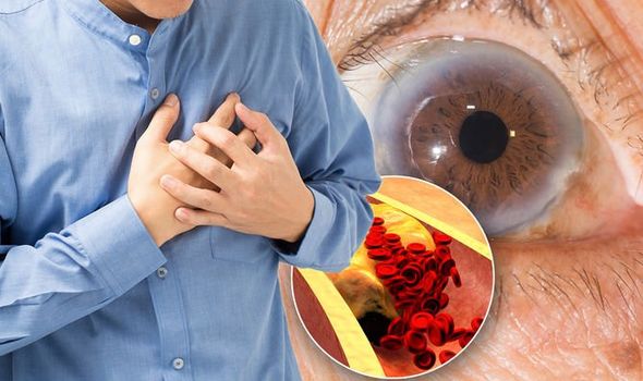 Quais sintomas de colesterol alto