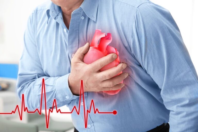 Infarto Agudo Do Miocárdio Ataque Cardíaco ️o Que é Veja Aqui